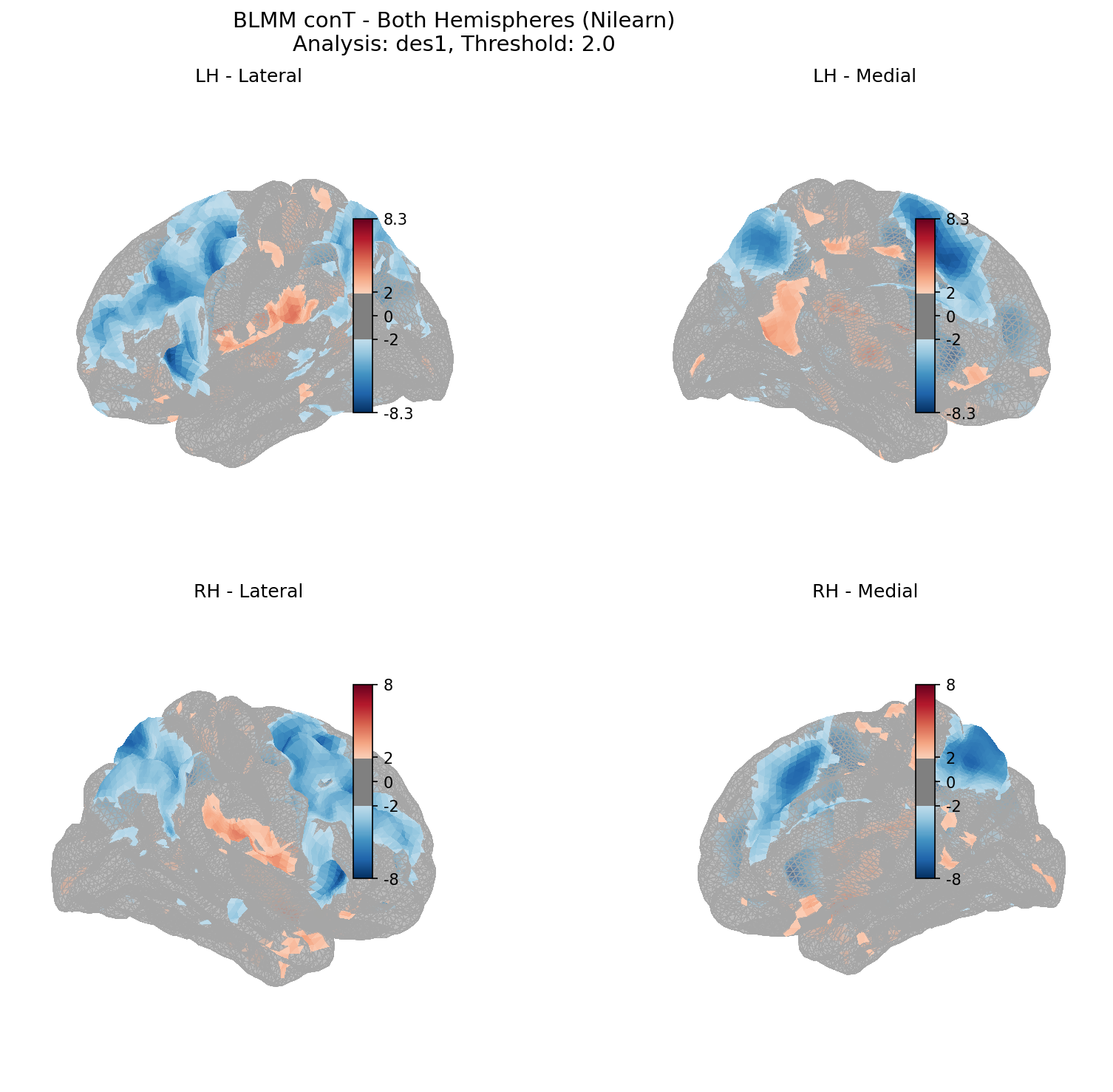 BLMM T-statistics for both hemispheres showing Design 1 results with threshold of 2.0